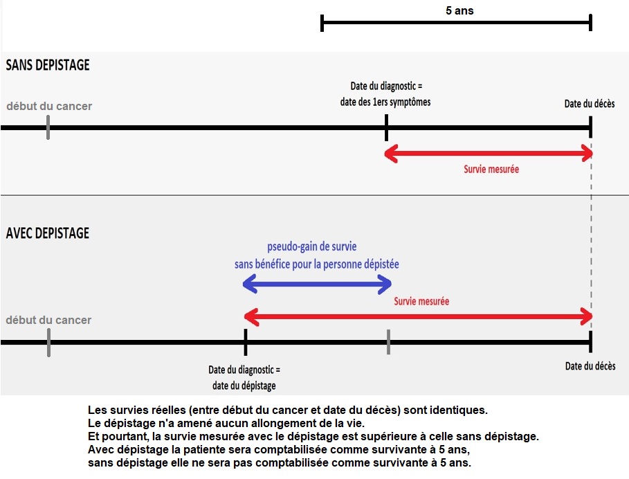 schéma de l'avance au diagnostic